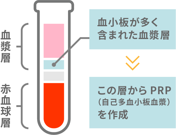 PRP療法はさまざまな部位に適応