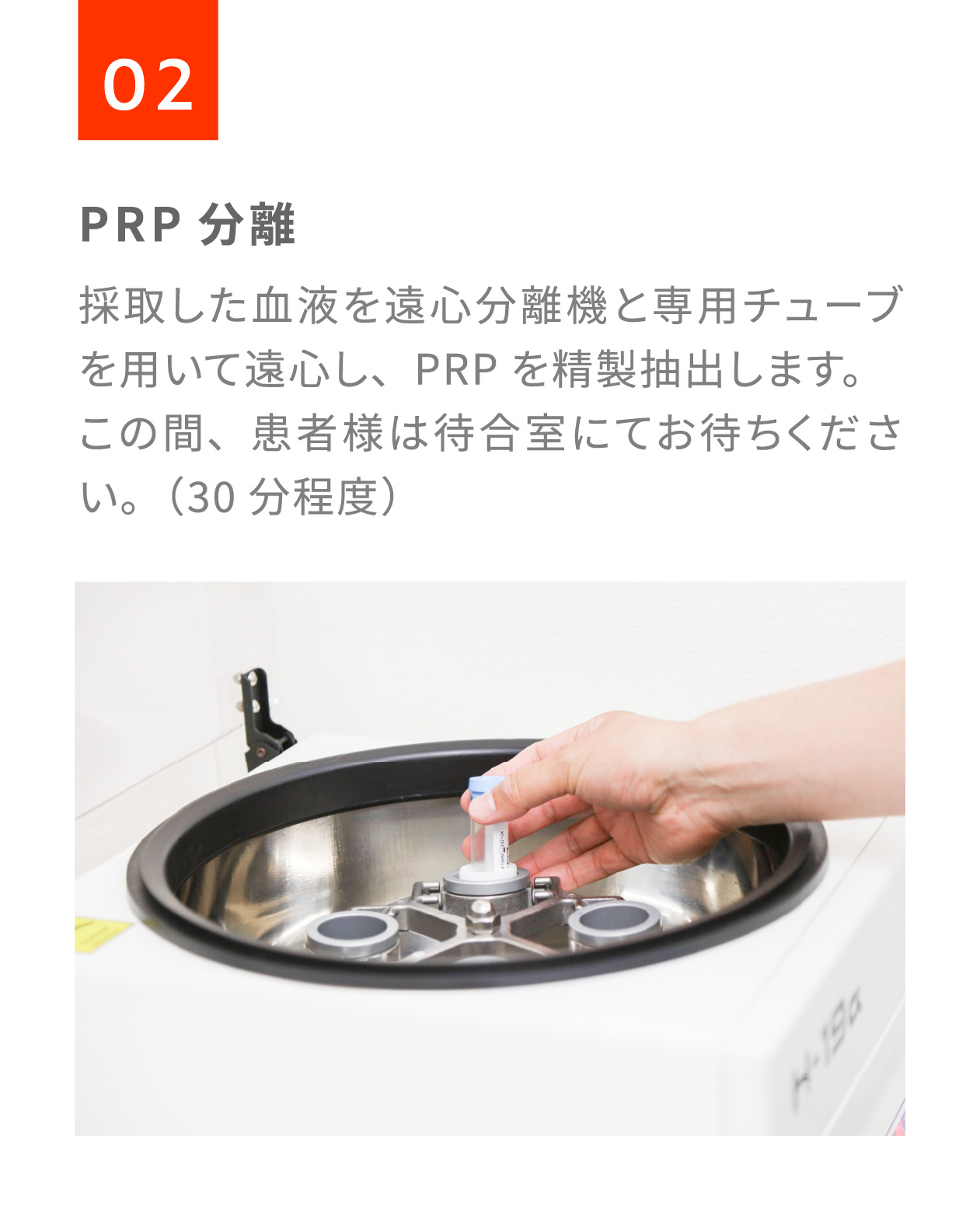 PRP分離